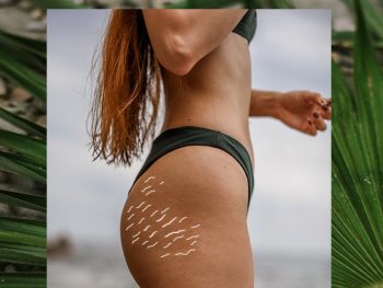 Does Fake Tan Cover Stretch Marks featured